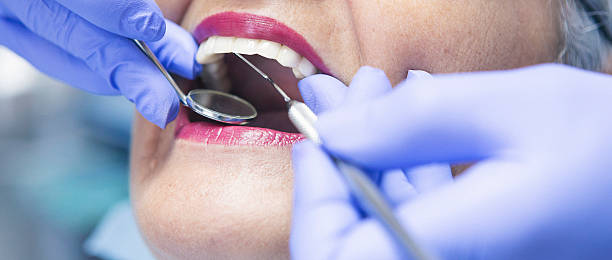 Best Emergency Dentist for Lost Fillings or Crowns in West Point, NE